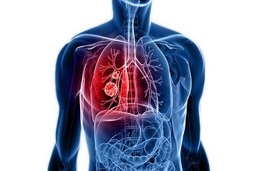 Pulmonary-medicine - Welcare Hospital